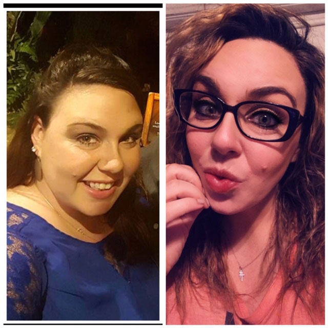 HCG Diet Rodriguez Rejuvenation Plastic Surgery & Rejuvenation